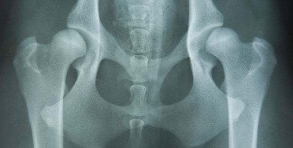 한림골격노화연구소 관련 사진